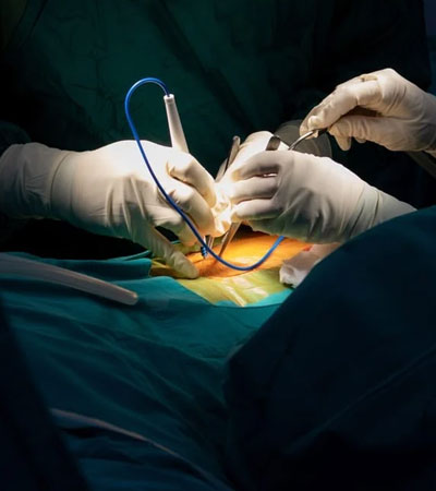 Minimally Invasive Surgery