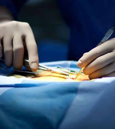 Caring for Surgical Incisions